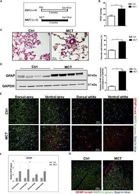 Experimental Pulmonary Hypertension Is Associated With Neuroinflammation in the Spinal Cord